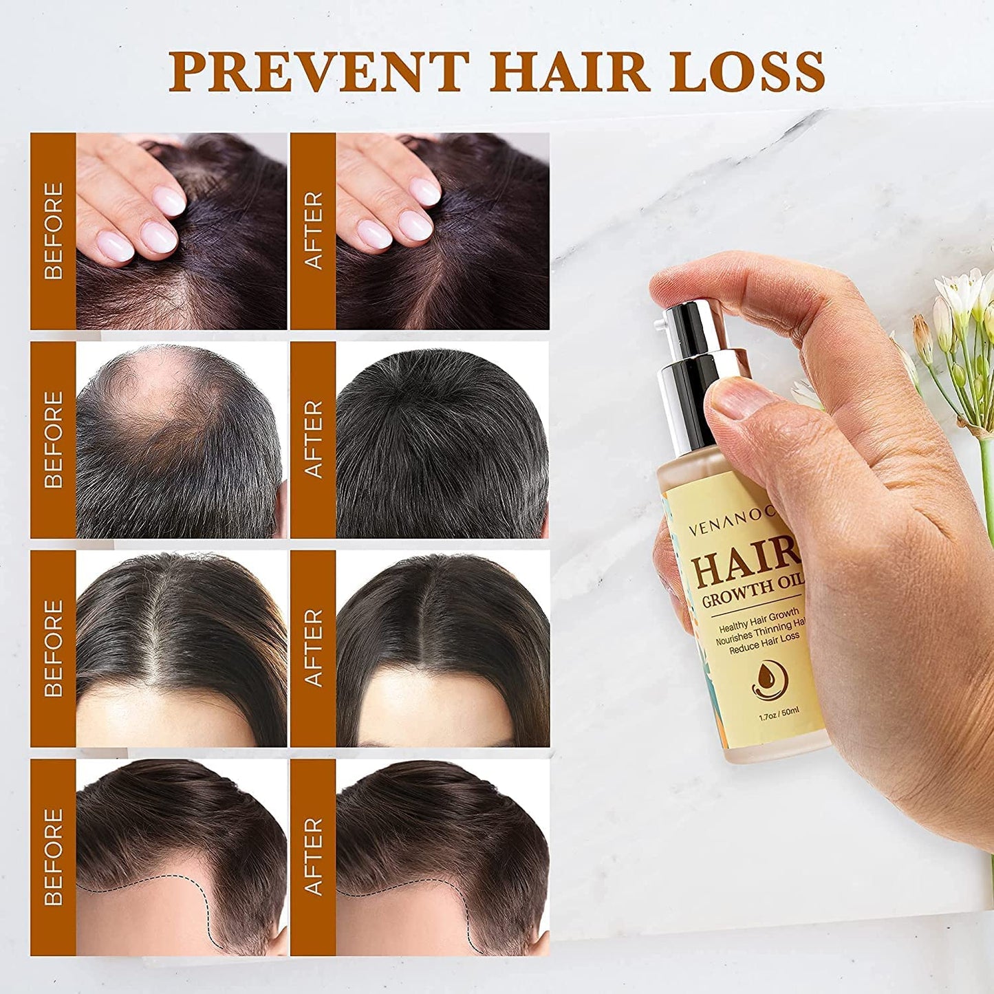 Biotin & Castor oil & Rosemary Oil for Hair Growth for Women, hair loss treatments, hair oil for dry damaged hair and growth, Hair Growth Serum for Thicker Longer Fuller Healthier Hair, All Natural Vitamin Rich Treatment